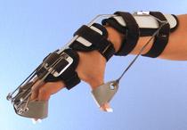#8A Dorsal Wrist Splint with Outrigger.