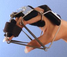 #2B Knuckle Bender Splint to flex the metacarpophalangeal jointswith extra segment to flex the distal joints