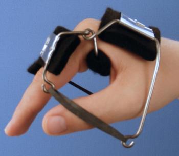 #2 Knuckle Bender splint to flex the metacarpophalangeal joints.